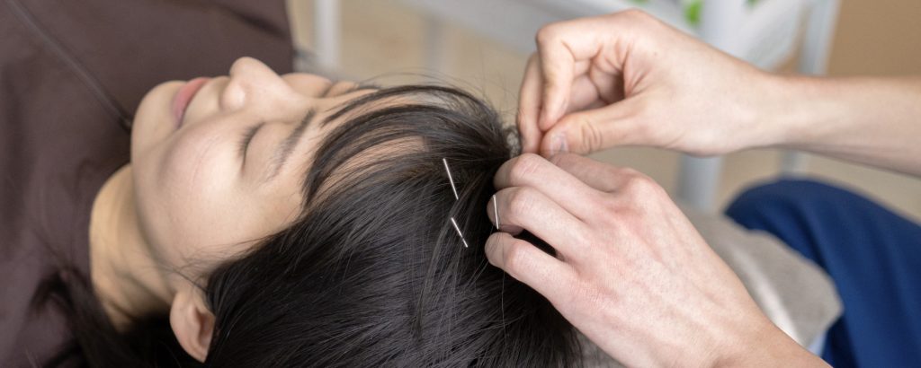 頭皮治療を受ける女性